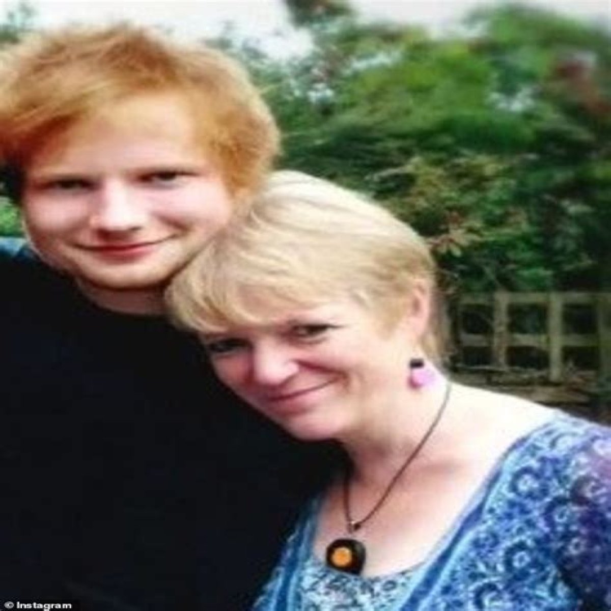 Did Ed Sheeran's Mom Pass Away? Uncovering The Truth