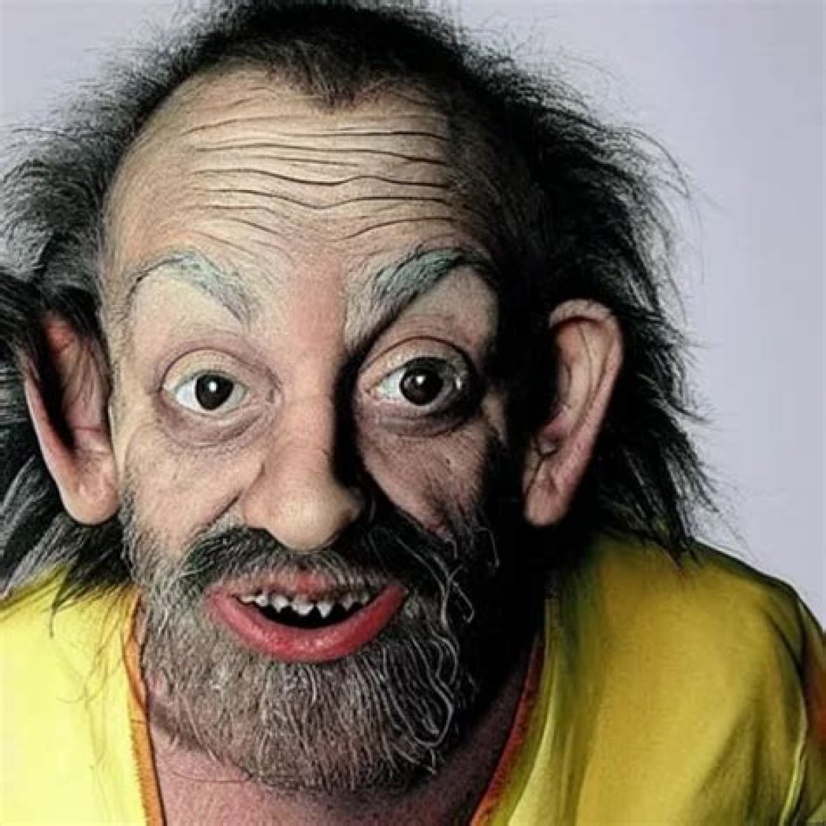 Discoveries And Insights On The "Ugliest Man Alive"