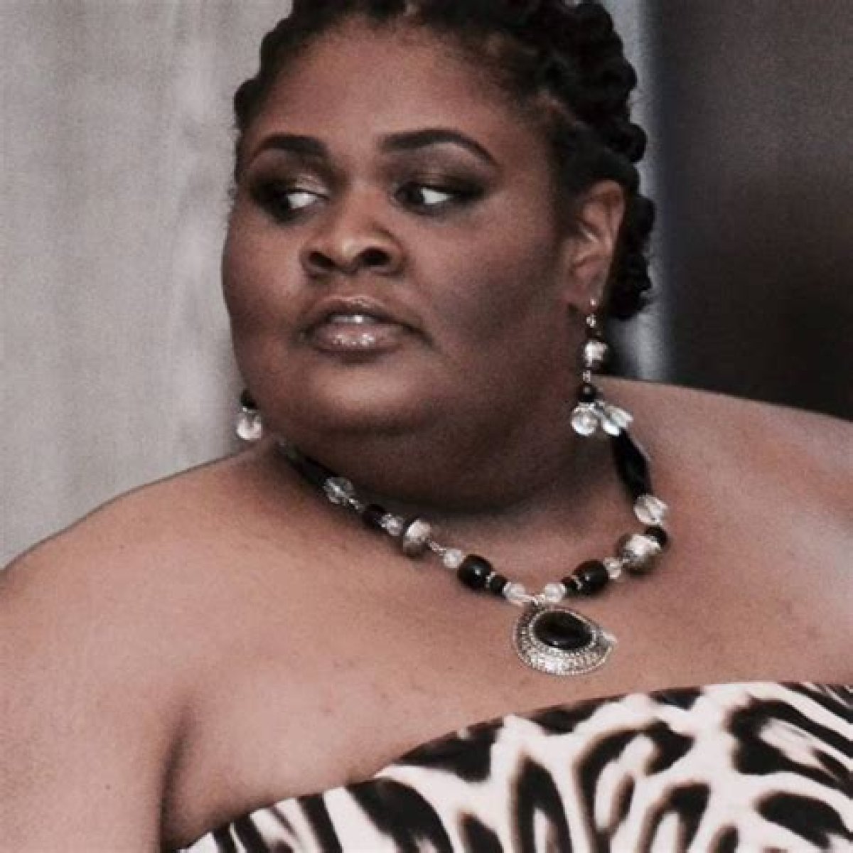 Katia Page: Who Was She? Battle with Lipoedema, Obituary, Death, Tribute, Family and More