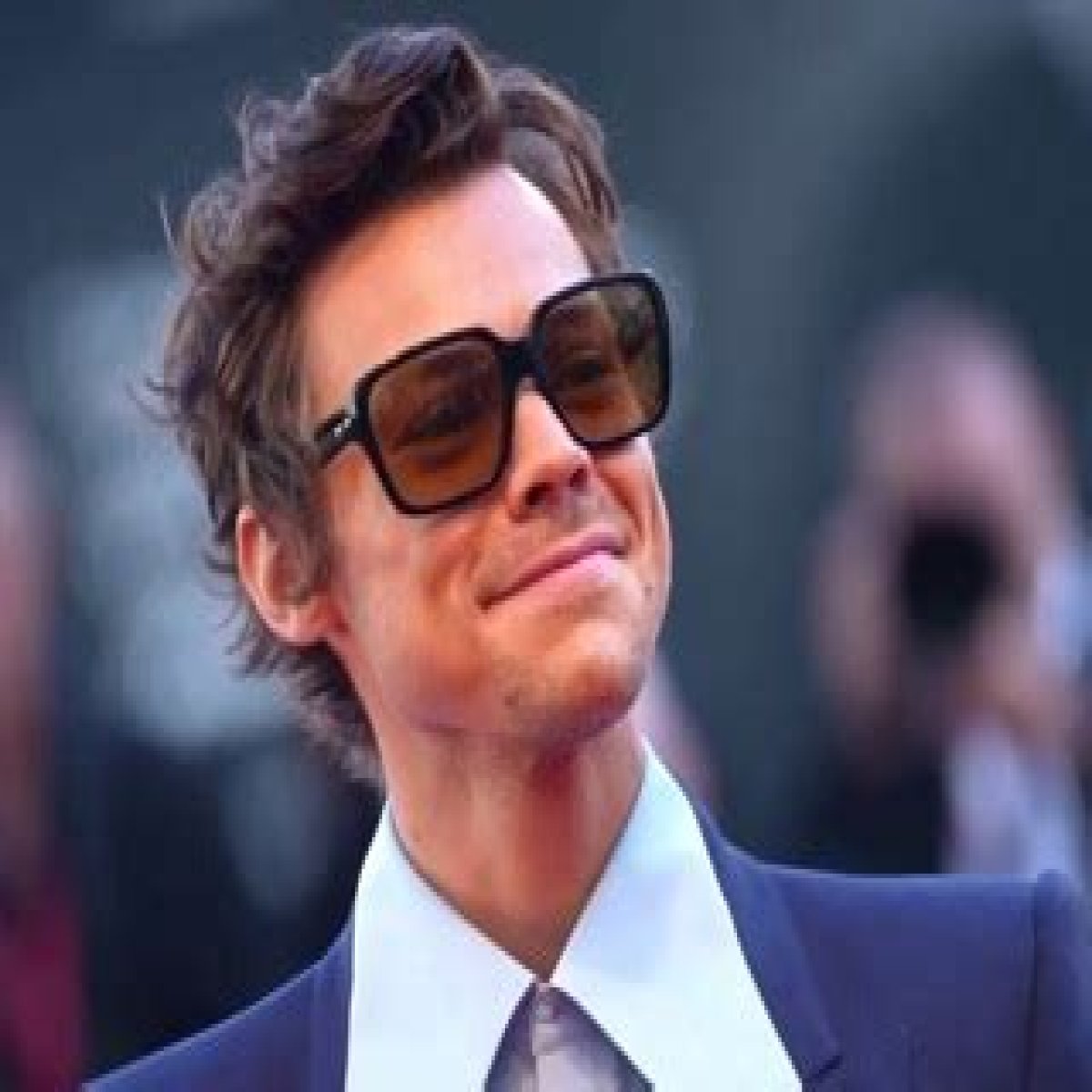 The Curious Case: Harry Styles' Journey Of Losing And Regaining Hair