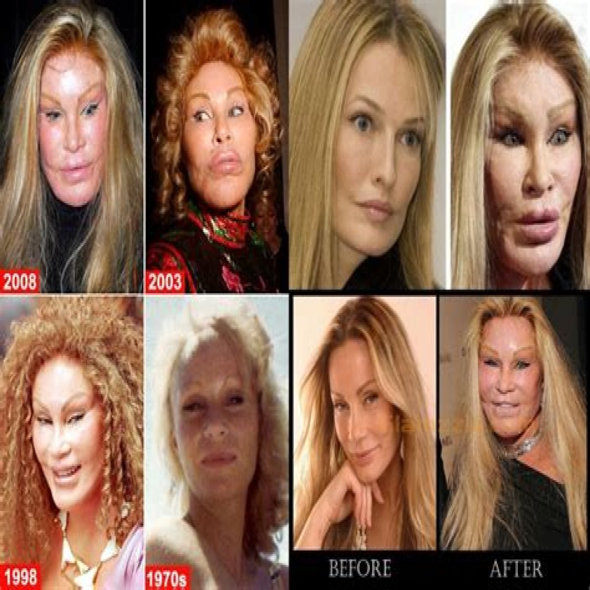 The Enigmatic Transformation Of Jocelyn Wildenstein: A Journey Of Excess And Controversy