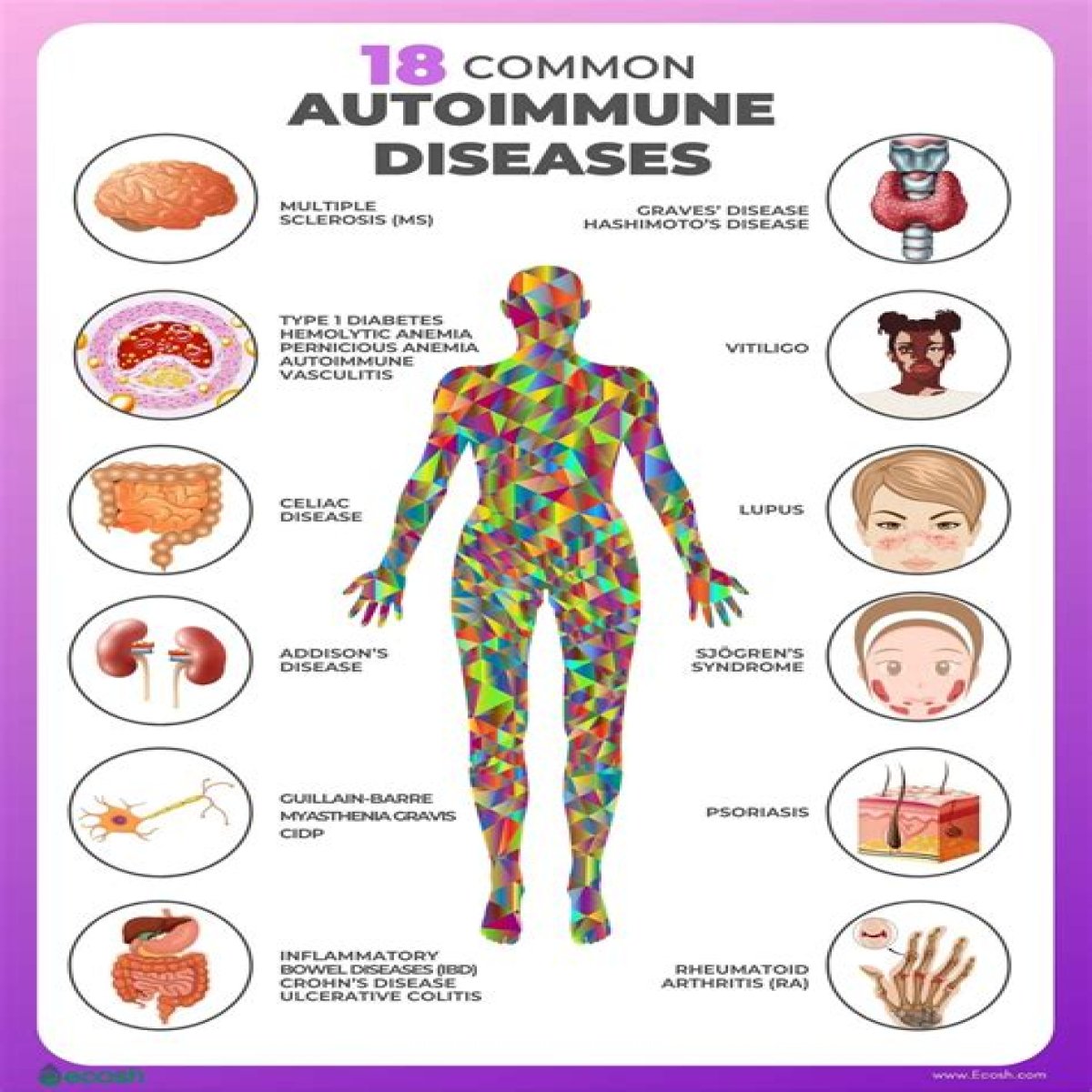The Ultimate Guide To RADamm: Understanding And Treating This Autoimmune Disease