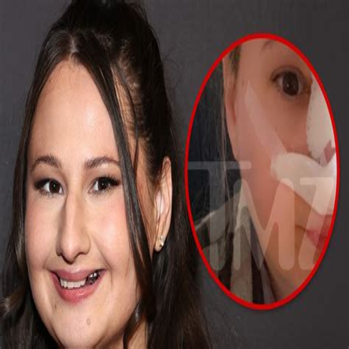 Unveiling The Truth: Did Gypsy Rose Get New Teeth?