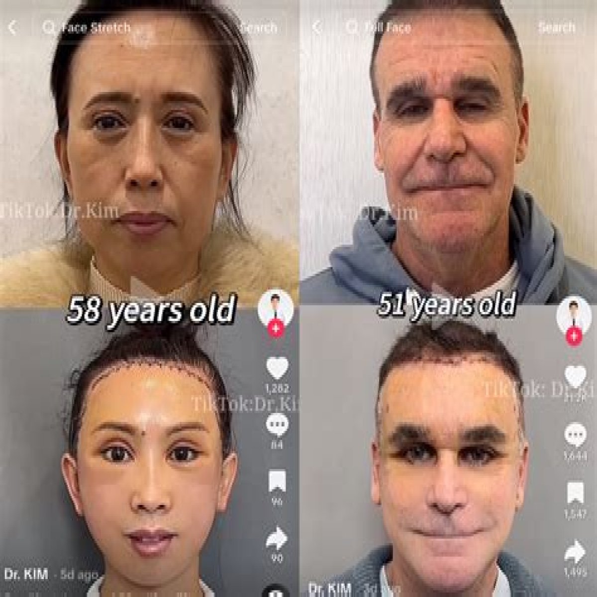 Unveiling The Worst Plastic Surgery Nightmares: Discoveries And Insights