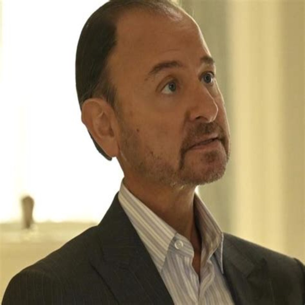 Why Fisher Stevens' Neck Defies Expectations